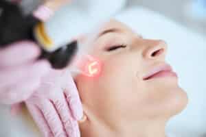 What Are the Benefits of Laser Skin Resurfacing?