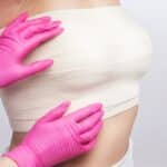 Close-up of a woman's chest with a bandage, representing recovery after silicone breast explant surgery and a breast lift following implant removal