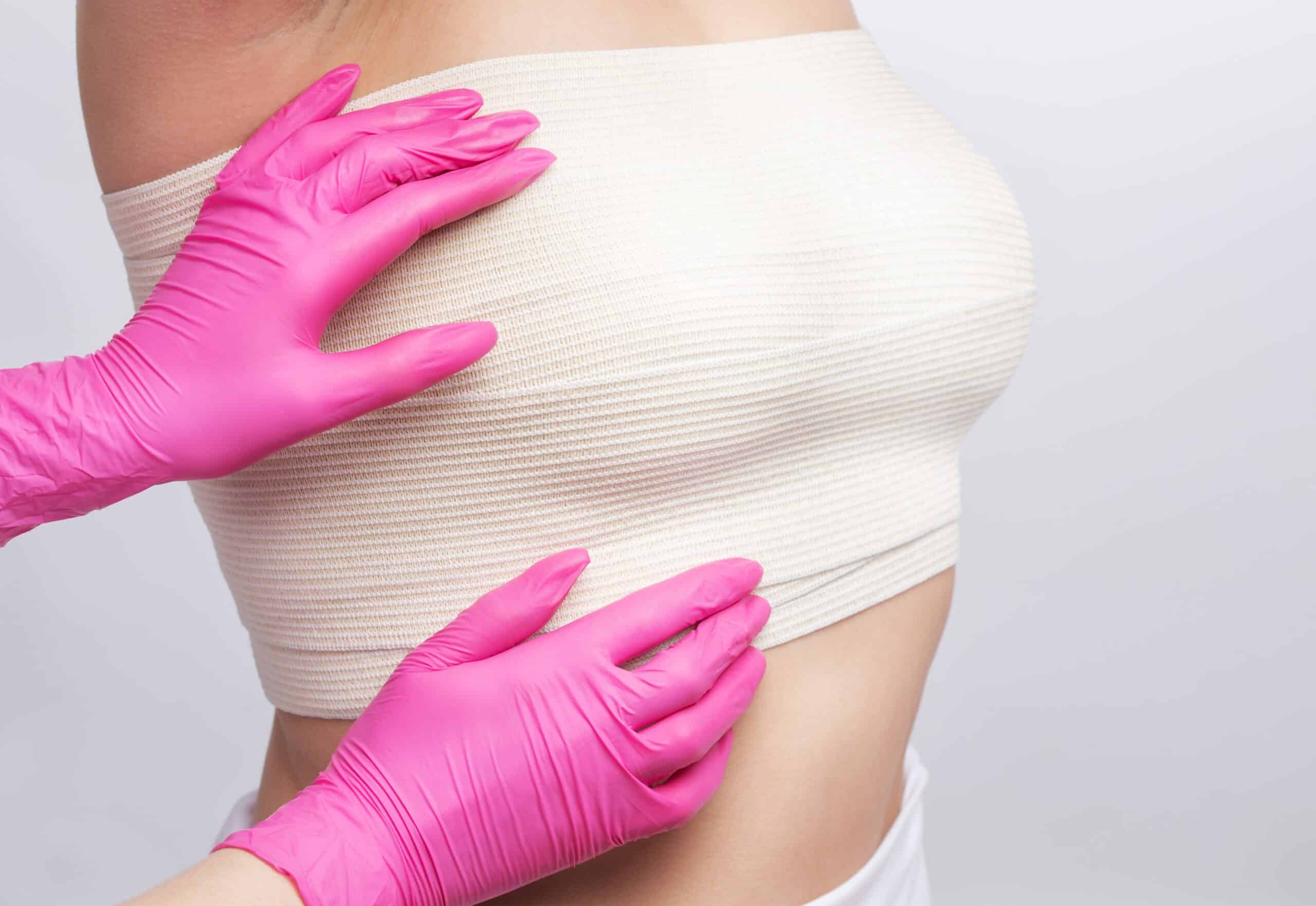 Close-up of a woman's chest with a bandage, representing recovery after silicone breast explant surgery and a breast lift following implant removal