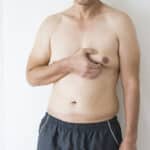 A bare-chested man pinches one breast, showing excess tissue or gynecomastia