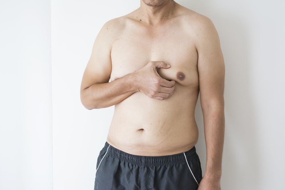 A bare-chested man pinches one breast, showing excess tissue or gynecomastia