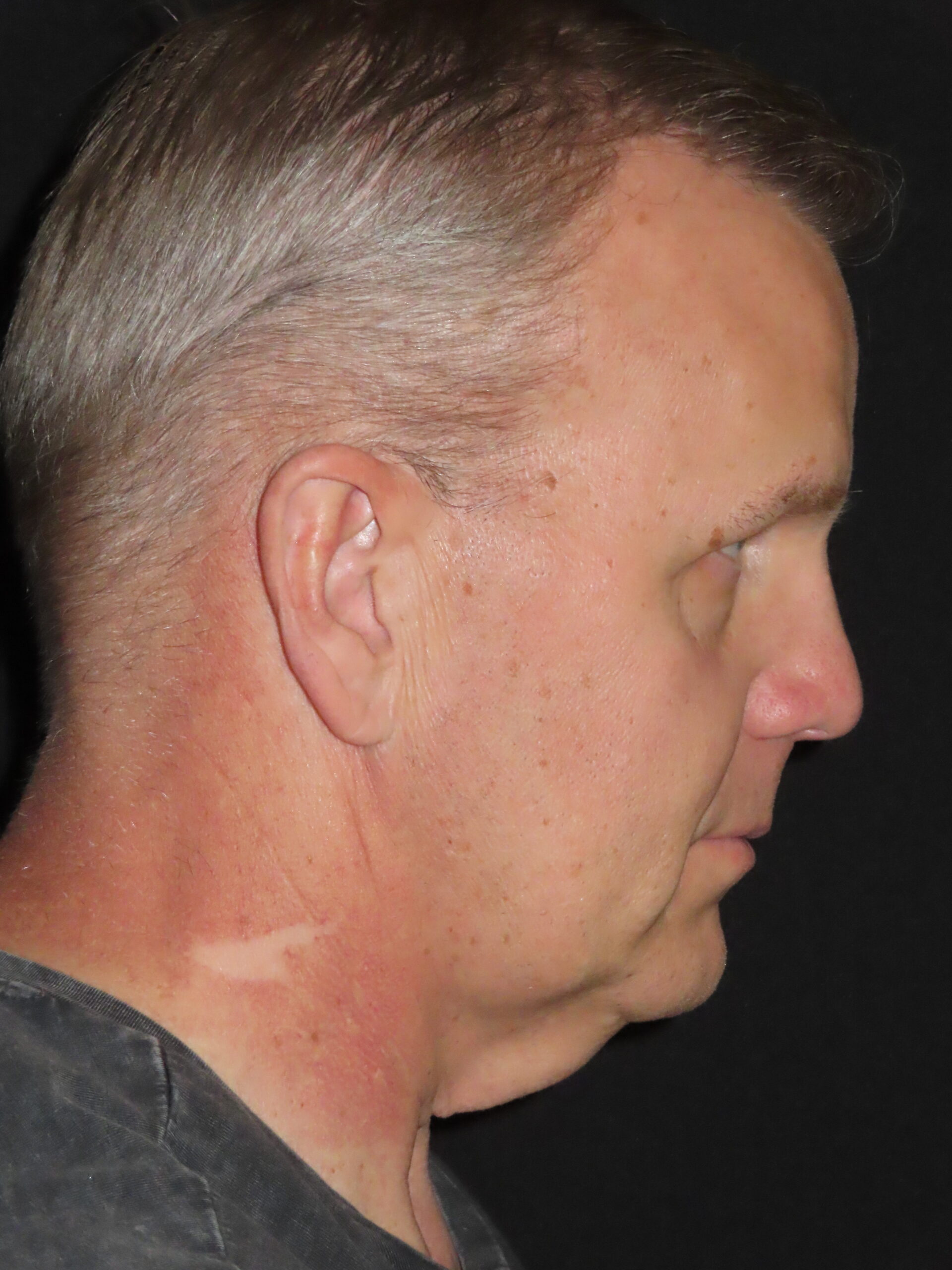 Face Procedures