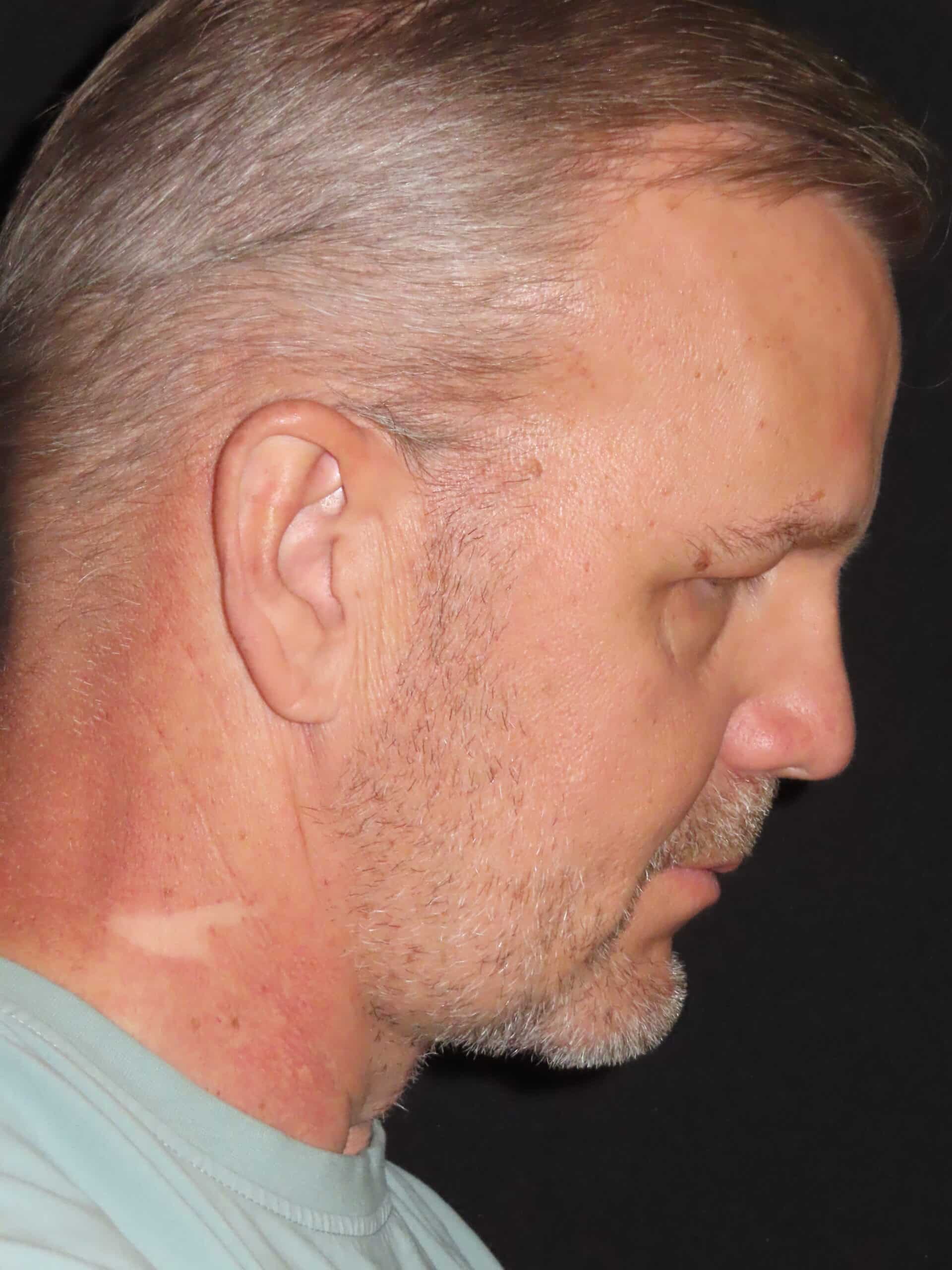 Face Procedures