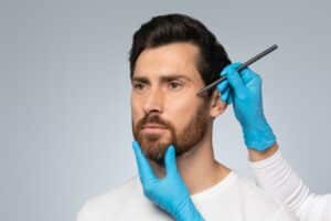 Man who is planning a facelift during his consultation appointment