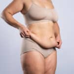 Scottsdale woman hold her loose C-section shelf before a tummy tuck