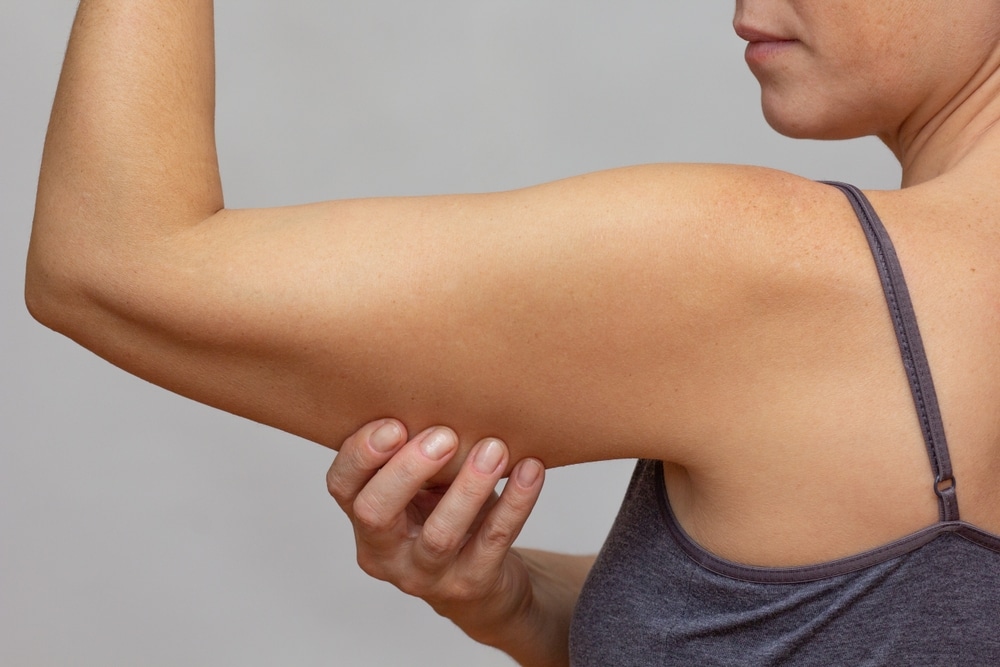Woman pinches upper arm skin in Scottsdale prior to an arm lift